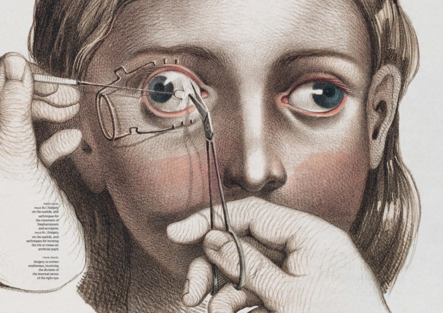 ►藝術設計►暢銷書► 手術劇場：470幀重現19世紀外科革命及器械的醫療繪畫