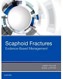 Scaphoid Fractures: Evidence-based Management