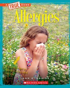 Allergies