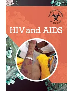 HIV and AIDS