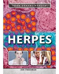 Herpes