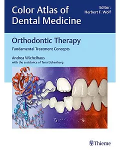 Orthodontic Therapy: Fundamental Treatment Concepts