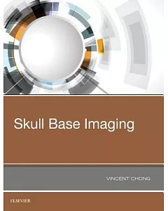 Skull Base Imaging