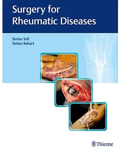 Surgery for Rheumatic Diseases