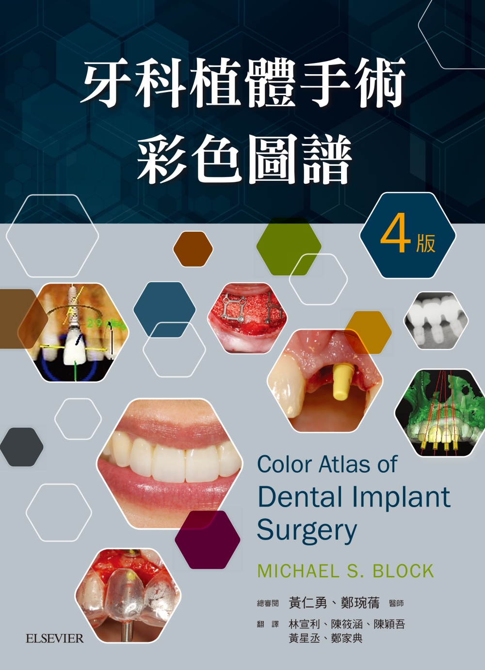 牙科植體手術彩色圖譜（4版）