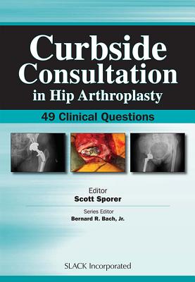 Curbside Consultation in Hip Arthroplasty: 49 Clinical Questions