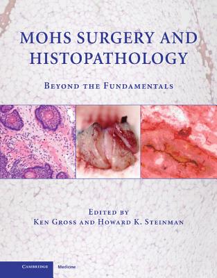 Mohs Surgery and Histopathology: Beyond the Fundamentals