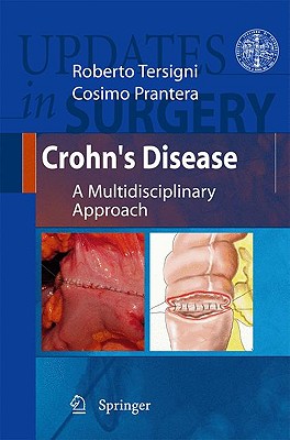 Crohn’s Disease: A Multidisciplinary Approach