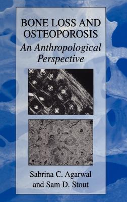 Bone Loss and Osteoporosis: An Anthropological Perspective