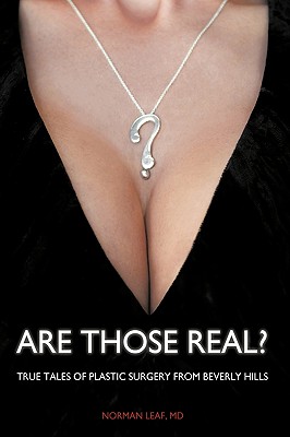 Are Those Real?: True Tales of Plastic Surgery from Beverly Hills