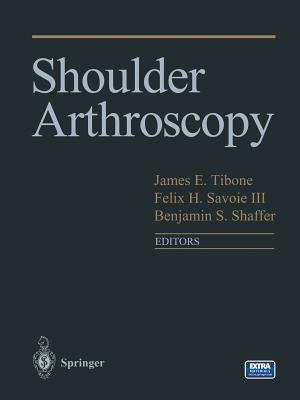 Shoulder Arthroscopy