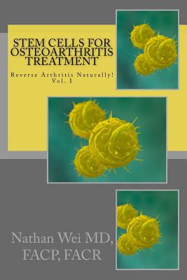 Stem Cells for Osteoarthritis Treatment: Discover the ”Inside” Secrets