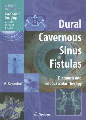 Dural Cavernous Sinus Fistulas: Diagnosis and Endovascular Therapy