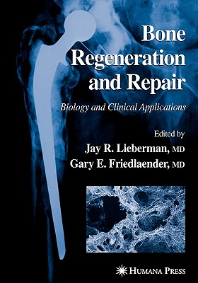 Bone Regeneration and Repair: Biology and Clinical Applications