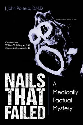 Nails That Failed: A Medically Factual Mystery