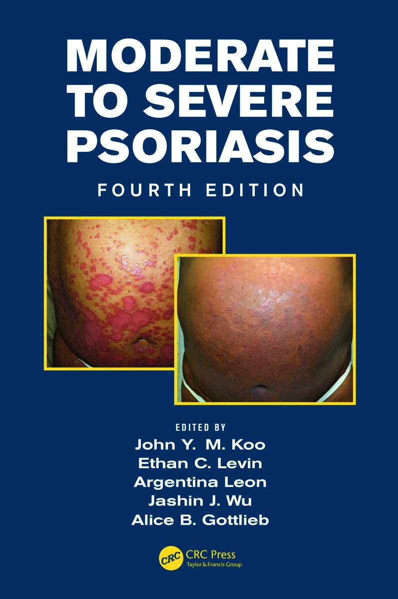 Moderate to Severe Psoriasis, Fourth Edition