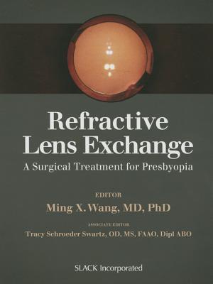 Refractive Lens Exchange: A Surgical Treatment for Presbyopia