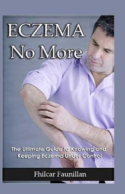 Eczema Cure