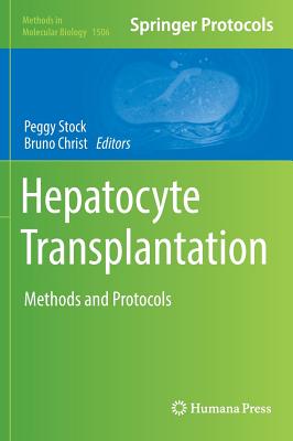 Hepatocyte Transplantation: Methods and Protocols