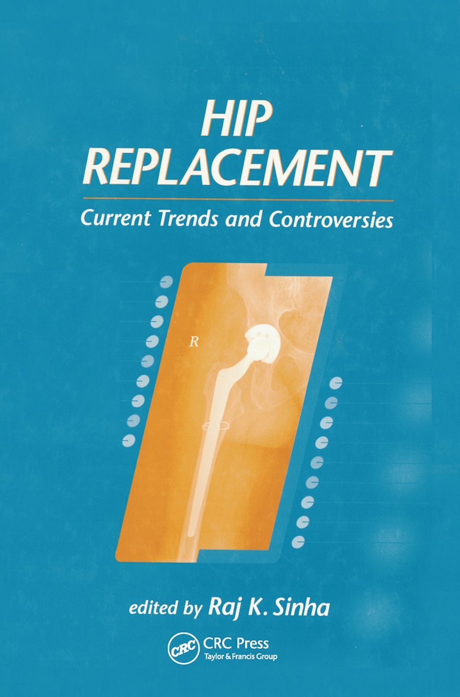 Hip Replacement: Current Trends and Controversies