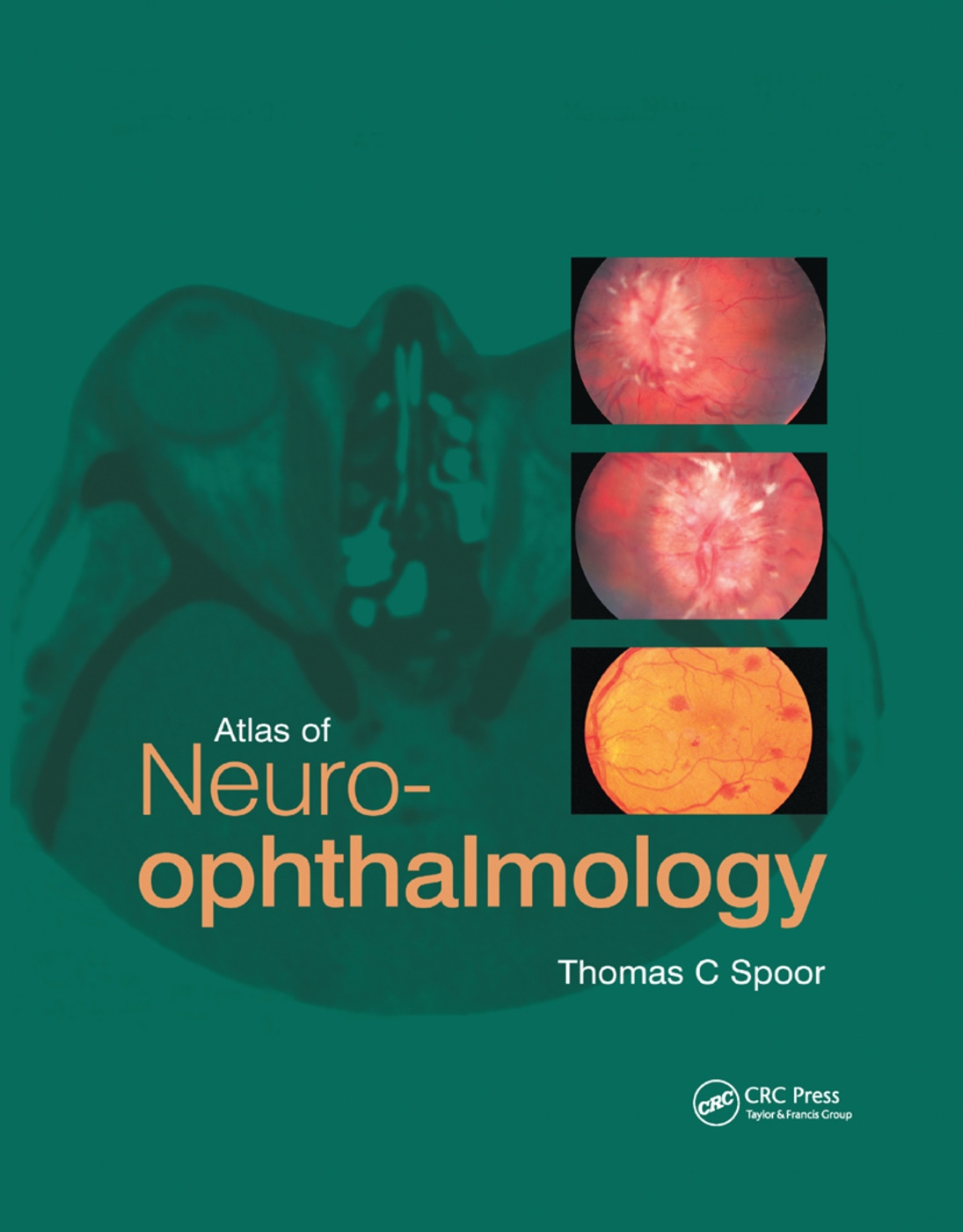 Atlas of Neuro-Ophthalmology