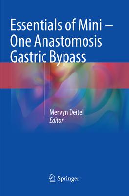 Essentials of Mini ‒ One Anastomosis Gastric Bypass