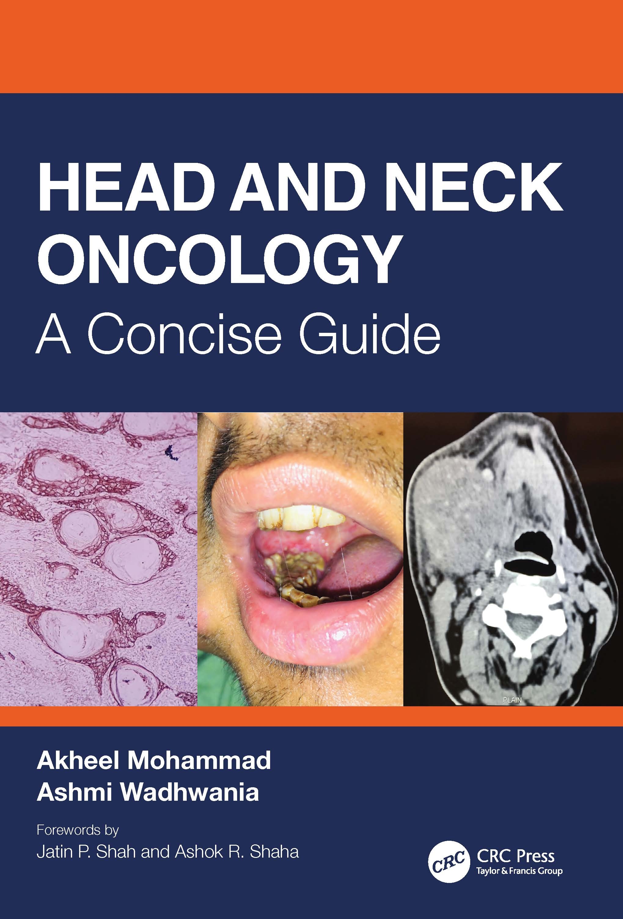 Head and Neck Oncology: A Concise Guide