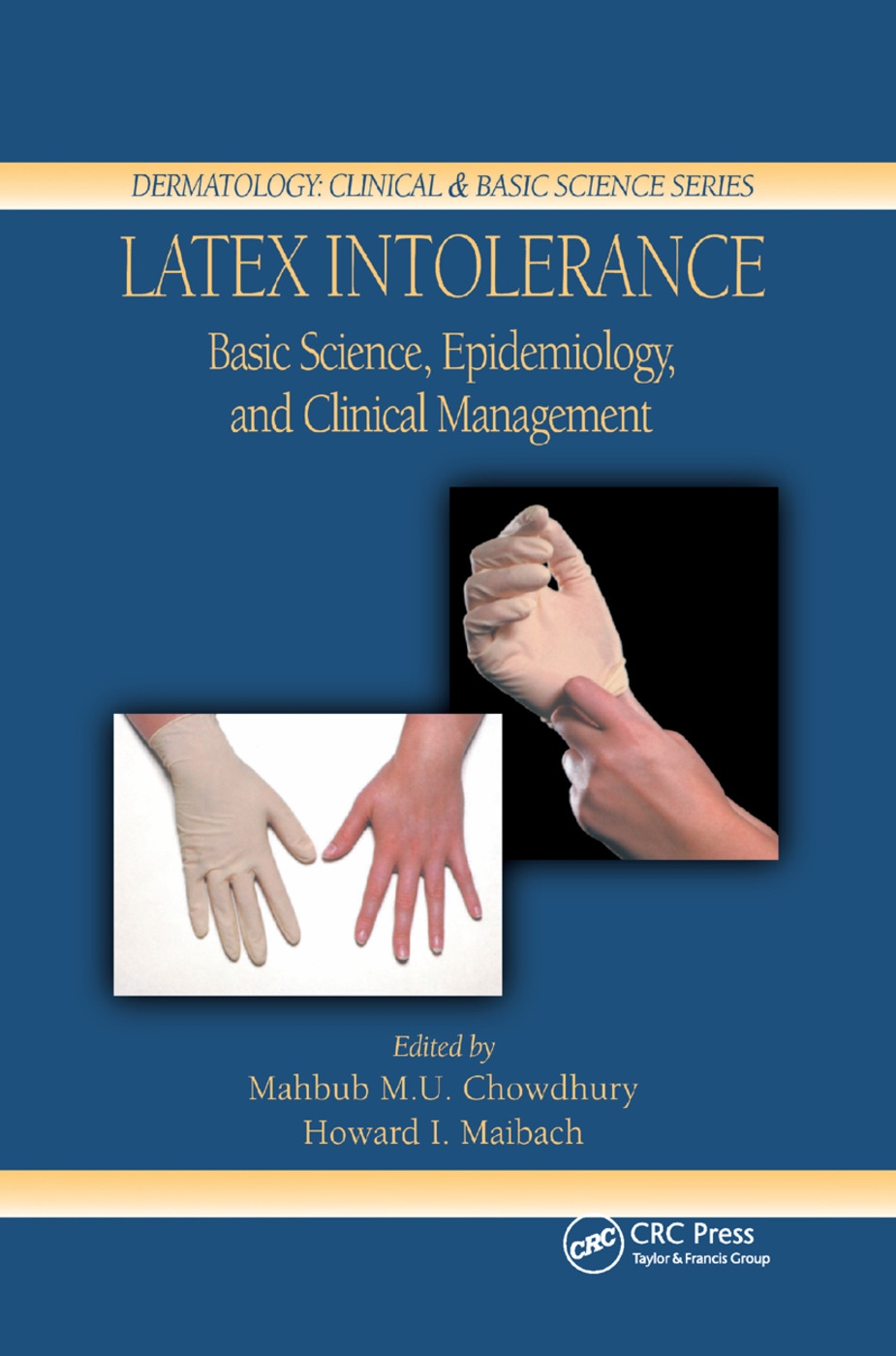 Latex Intolerance: Basic Science, Epidemiology, and Clinical Management