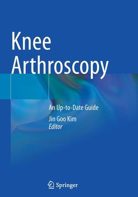 Knee Arthroscopy: An Up-to-Date Guide