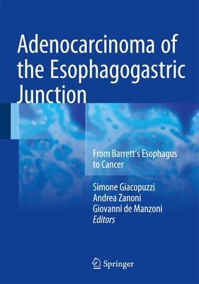 Adenocarcinoma of the Esophagogastric Junction: From Barrett’s Esophagus to Cancer