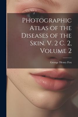 Photographic Atlas of the Diseases of the Skin. V. 2 C. 2, Volume 2