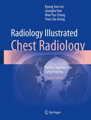 Radiology Illustrated: Chest Radiology: Pattern Approach for Lung Imaging