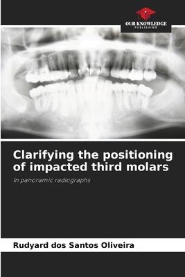 Clarifying the positioning of impacted third molars