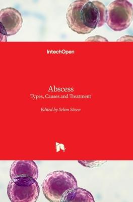 Abscess - Types, Causes and Treatment: Types, Causes and Treatment