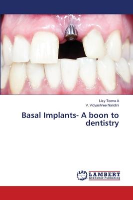 Basal Implants- A boon to dentistry