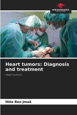 Heart tumors: Diagnosis and treatment