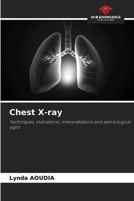 Chest X-ray