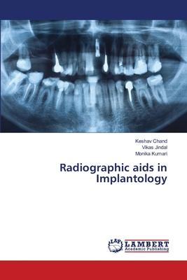 Radiographic aids in Implantology